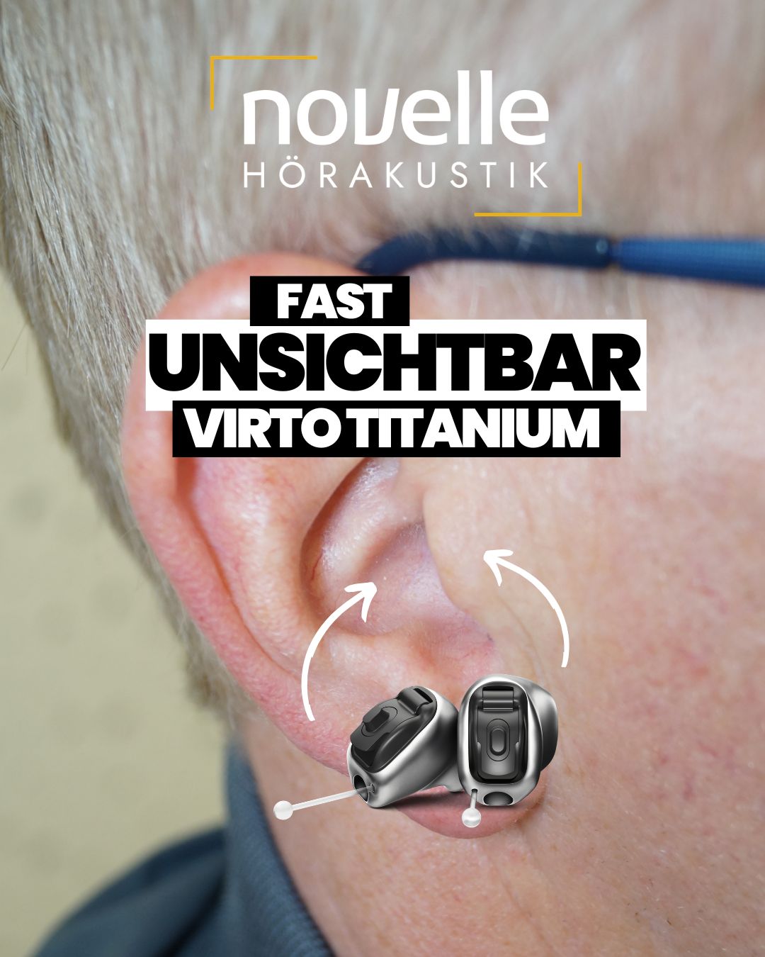 Novelle Hörakustik in Singen Hörgeräte in Singen - Kunde - Virto Titanium Infinio - In dem Ohr Hörgeräte