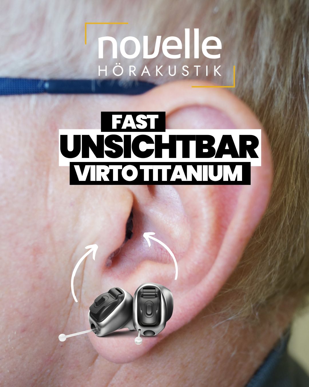 Novelle Hörakustik in Singen Hörgeräte in Singen - Kunde - Virto Titanium Infinio - In dem Ohr Hörgeräte