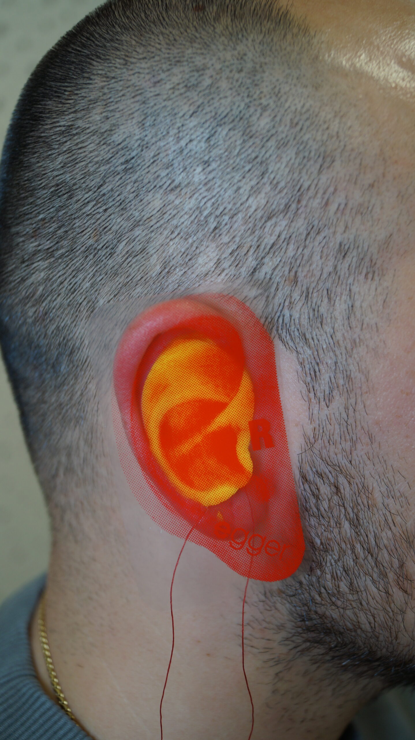 Gewinnspiel Novelle Hörakustik Singen - Hörakustik Singen - Högeräte Singen