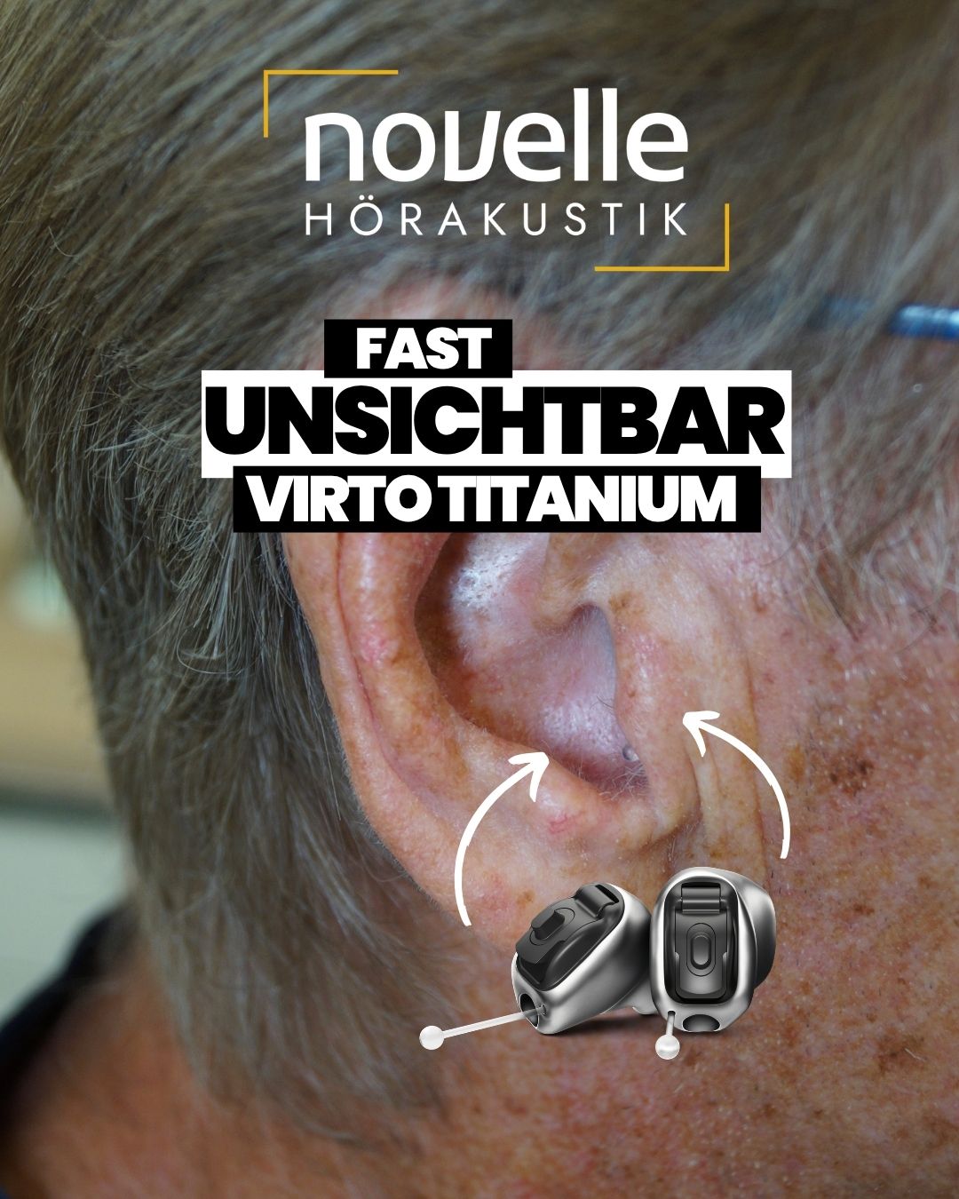Novelle Hörakustik in Singen am Hohentwiel Hörgeräte in Singen am Hohentwiel - Kunde - Phonak Virto Titanium Infinio - In dem Ohr Hörgeräte