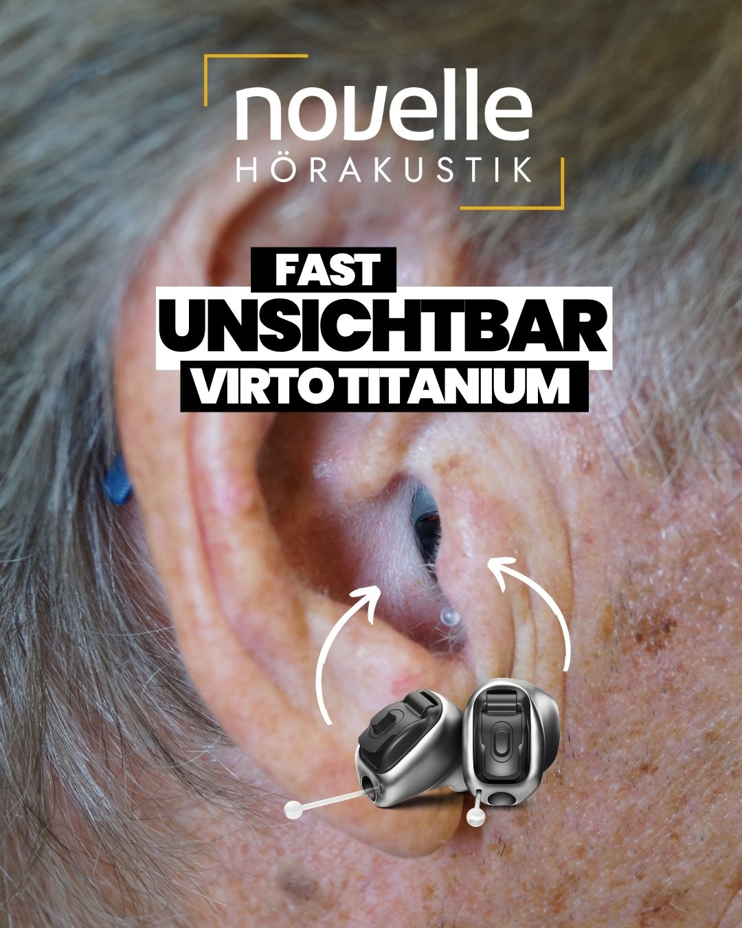 Novelle Hörakustik in Singen am Hohentwiel Hörgeräte in Singen am Hohentwiel - Kunde - Phonak Virto Titanium Infinio - In dem Ohr Hörgeräte