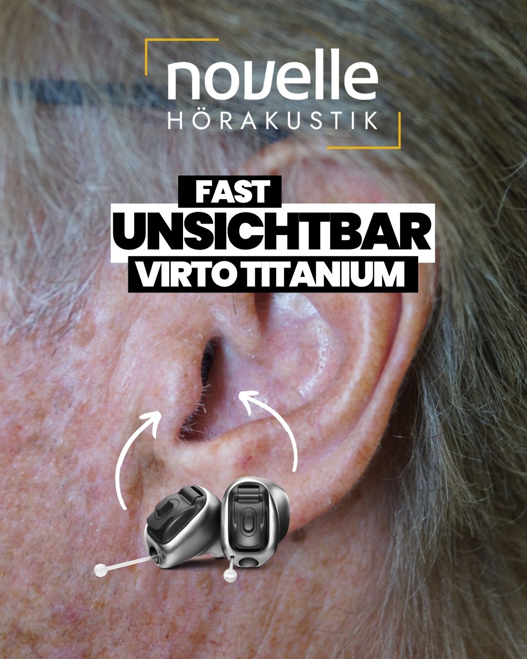 Novelle Hörakustik in Singen am Hohentwiel Hörgeräte in Singen am Hohentwiel - Kunde - Phonak Virto Titanium Infinio - In dem Ohr Hörgeräte