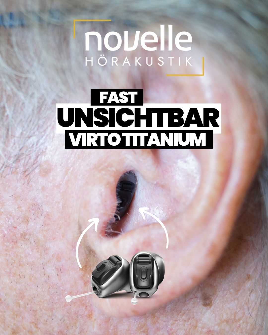 Novelle Hörakustik in Singen am Hohentwiel Hörgeräte in Singen am Hohentwiel - Kunde - Phonak Virto Titanium Infinio - In dem Ohr Hörgeräte