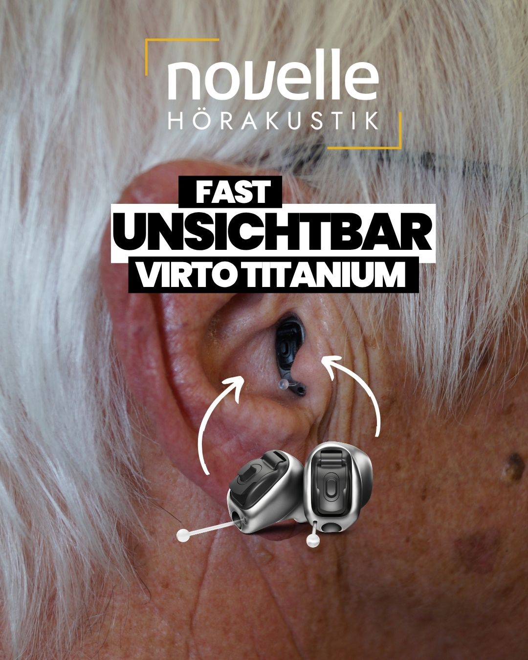 Novelle Hörakustik in Singen am Hohentwiel Hörgeräte in Singen am Hohentwiel - Kunde - Phonak Virto Titanium Infinio - In dem Ohr Hörgeräte